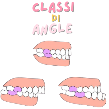 Le Classi di Angle